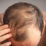 erkeklerde-kellige-neden-olan-icecekler-aciklandi-wMKnk7Fp